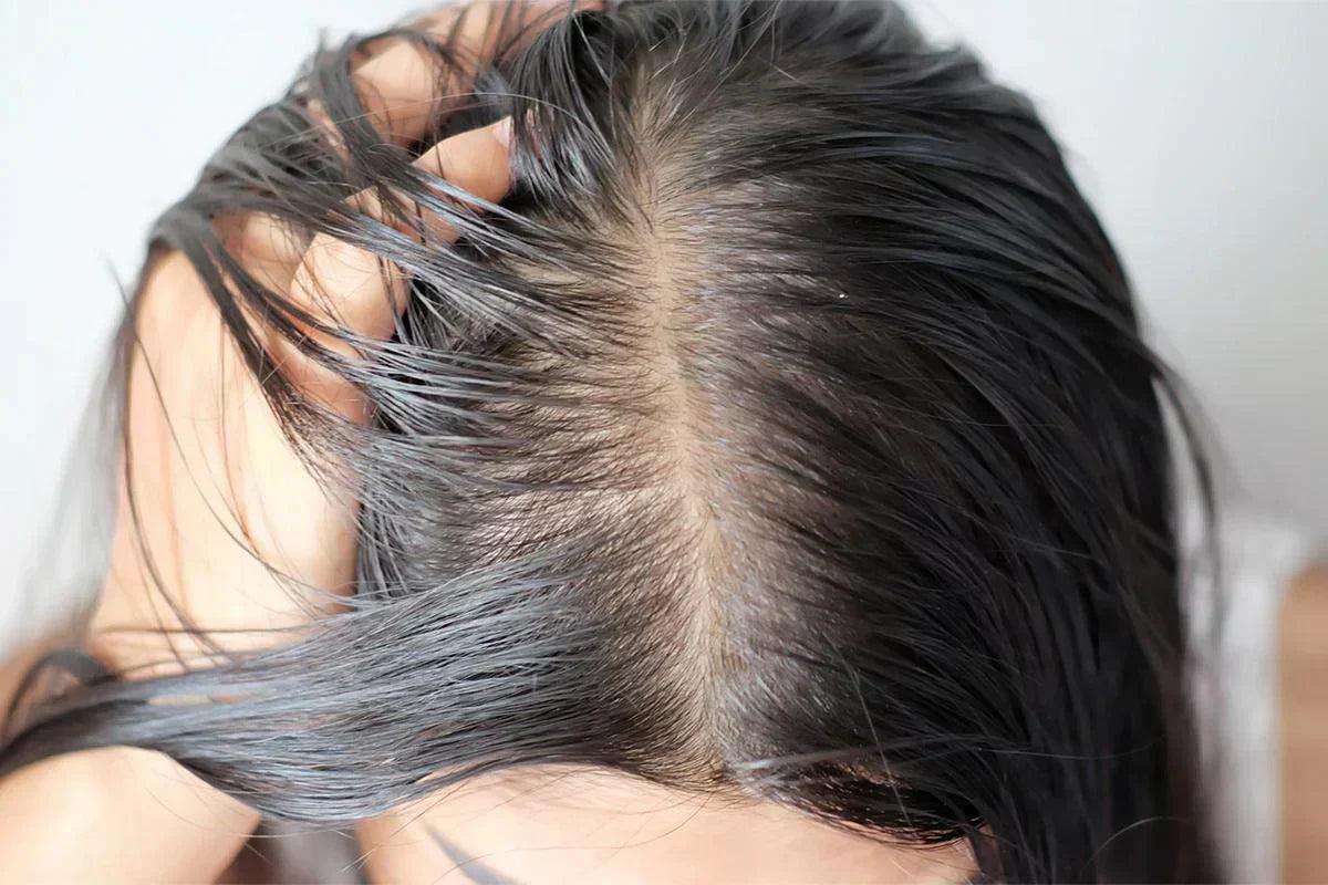 مراقبت از موهای چرب برای کاهش چربی پوست سر